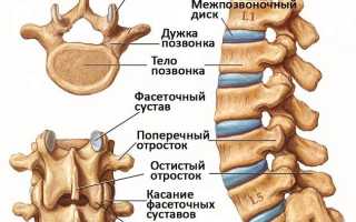 Симптомы и лечение артрита позвоночника