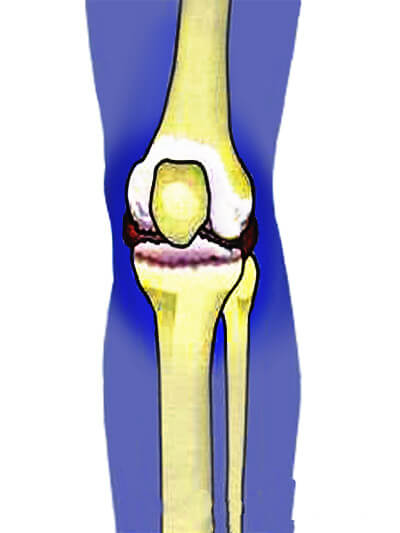 боль в колене