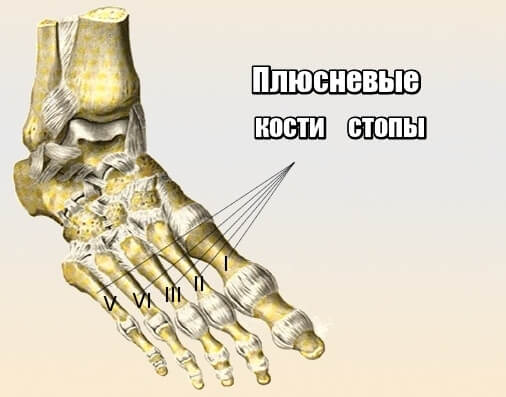 плюсневые кости стопы